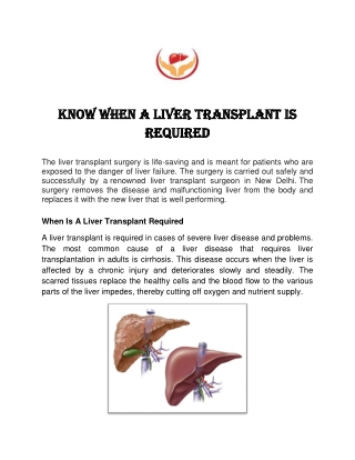 Know When A Liver Transplant Is Required