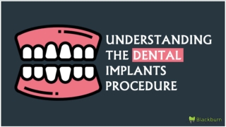 Understanding The Dental Implants Procedure