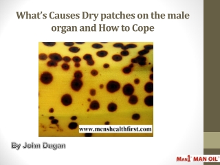 What’s Causes Dry patches on the male organ and How to Cope