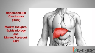 Hepatocellular Carcinoma Market