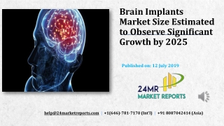 Brain Implants Market Size Estimated to Observe Significant Growth by 2025