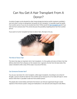 Can You Get A Hair Transplant From A Donor?