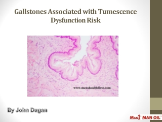 Gallstones Associated with Tumescence Dysfunction Risk