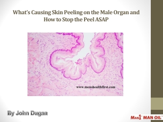 What’s Causing Skin Peeling on the Male Organ and How to Stop the Peel ASAP