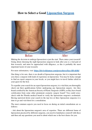 How to Select a Good Liposuction Surgeon