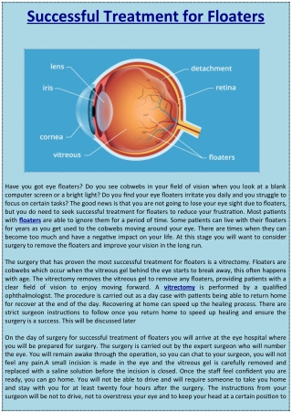 Successful Treatment for Floaters.