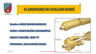 SÍNDROME DE GUILLAIN BARRÉ