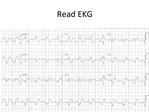Read EKG