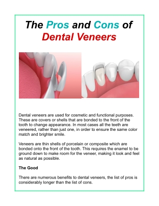 The Pros and Cons of Dental Veneers