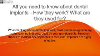 All you need to know about dental implants