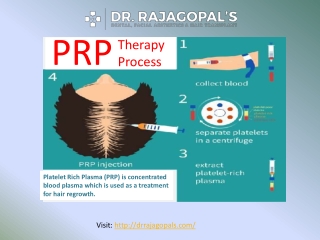 PRP Therapy Along With Hair Transplant Surgery In Gurgaon - Dr. RajaGopal's Clinic.