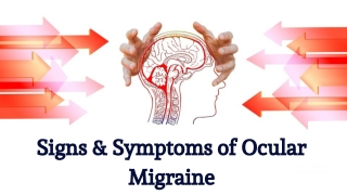 Signs & Symptoms of Ocular Migraine