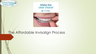 The Affordable Invisalign Process