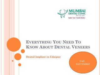 Everything You Need To Know About Dental Veneers