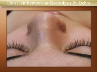 Chin Hair Removal at Electrolysis By Debra