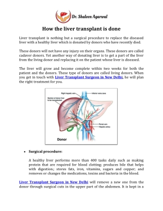 How the liver transplant is done