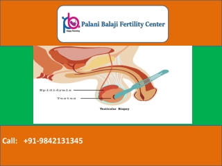 Good Fertility Doctor In Chennai