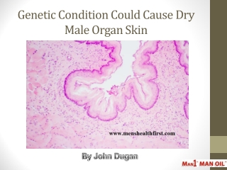 Genetic Condition Could Cause Dry Male Organ Skin