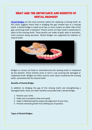 What are The Importance and Benefits of Dental Bridges