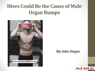 Hives Could Be the Cause of Male Organ Bumps