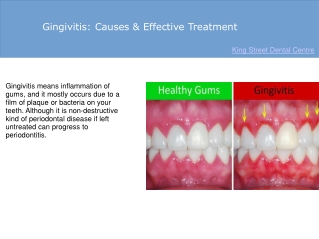 Gingivitis: Causes & Effective Treatment