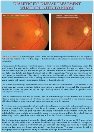 Diabetic Eye Disease Treatment What You Need to Know