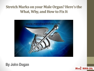 Stretch Marks on your Male Organ? Here’s the What, Why, and How to Fix It