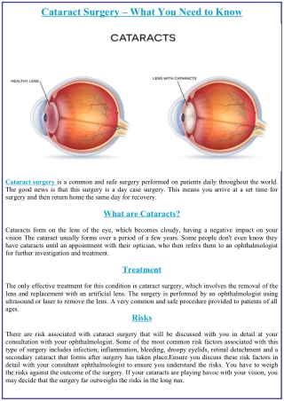 Cataract Surgery – What You Need to Know