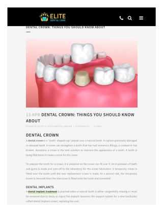 Dental Crown: Things you should Know About | Elite Dental Care Tracy