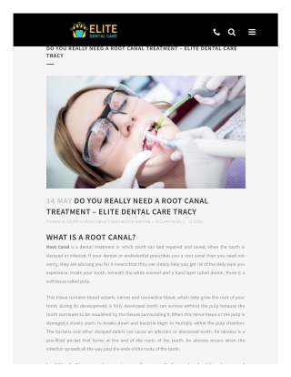 Root Canal Treatment Tracy - Do You Really Need it | Elite Dental Care