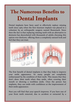 The Numerous Benefits to Dental Implants