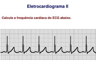 Eletrocardiograma II