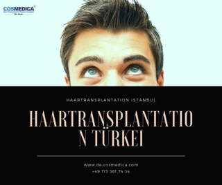 Dhi haartransplantation