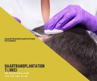 Haartransplantation ohne rasur