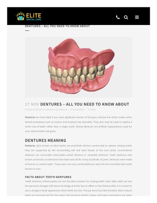 DENTURES – ALL YOU NEED TO KNOW ABOUT