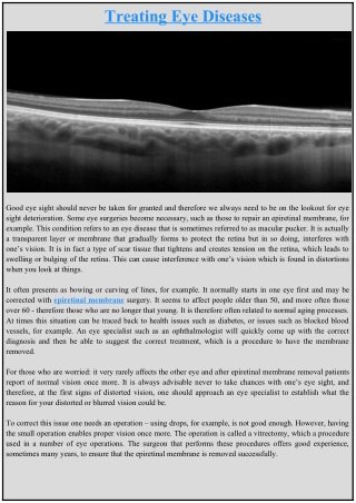 Treating Eye Diseases