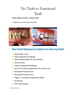 Dental Implants - Types , Procedure, Advantages - Deccan Multispeciality Hardikar Hospital