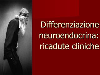 Differenziazione neuroendocrina: ricadute cliniche