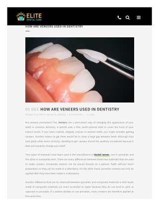 How are Veneers Used in Dentistry - Elite Dental Care Tracy