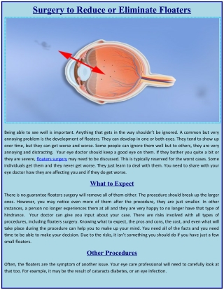 Surgery to Reduce or Eliminate Floaters