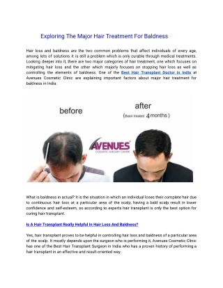 Exploring The Major Hair Treatment Options For Baldness