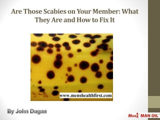 Are Those Scabies on Your Member: What They Are and How to Fix It