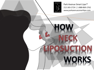 How Neck Liposuction Works
