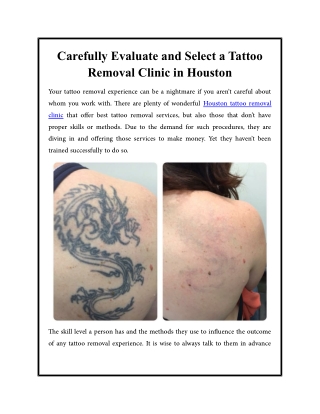 Carefully Evaluate and Select a Tattoo Removal Clinic in Houston