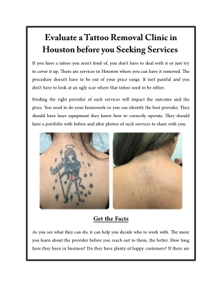 Evaluate a Tattoo Removal Clinic in Houston before you Seeking Services