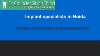Implant specialists in Noida