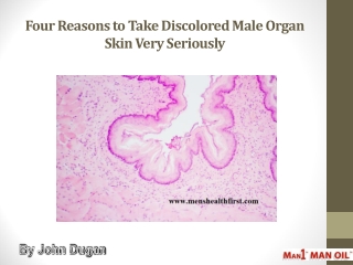 Four Reasons to Take Discolored Male Organ Skin Very Seriously