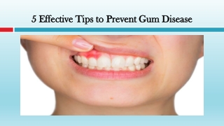 Effective Tips to Prevent Gum Disease
