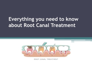 Everything you need to know about Root Canal Treatment