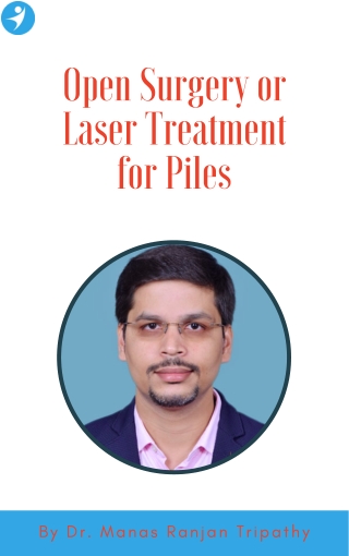 Open Surgery vs Laser treatment for Piles